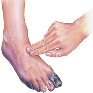 mhsds-limb-surgery mhsds-limb-surgery