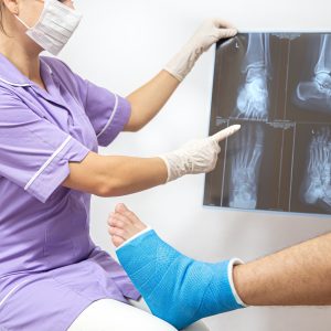 Bone fracture foot and leg on male patient being examined by a woman doctor in a hospital. Female doctor in a blue medical gown checking broken leg and shows the male patient lateral projection x-ray of foot and ankle.